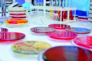 Blood-agar-plates
